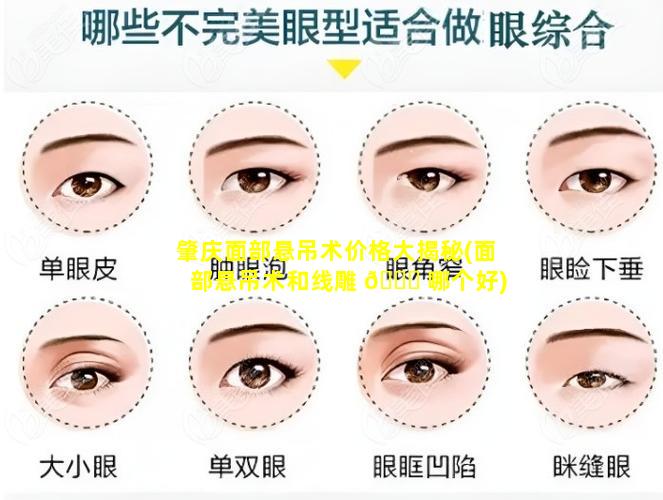 肇庆面部悬吊术价格大揭秘(面部悬吊术和线雕 🐅 哪个好)